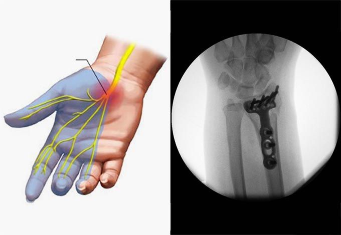 Wrist & Hand Surgery