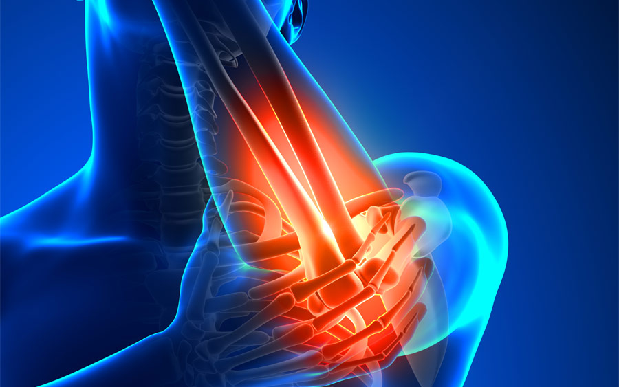 θεραπεία της ωλένιας νευρίτιδας του αγκώνα